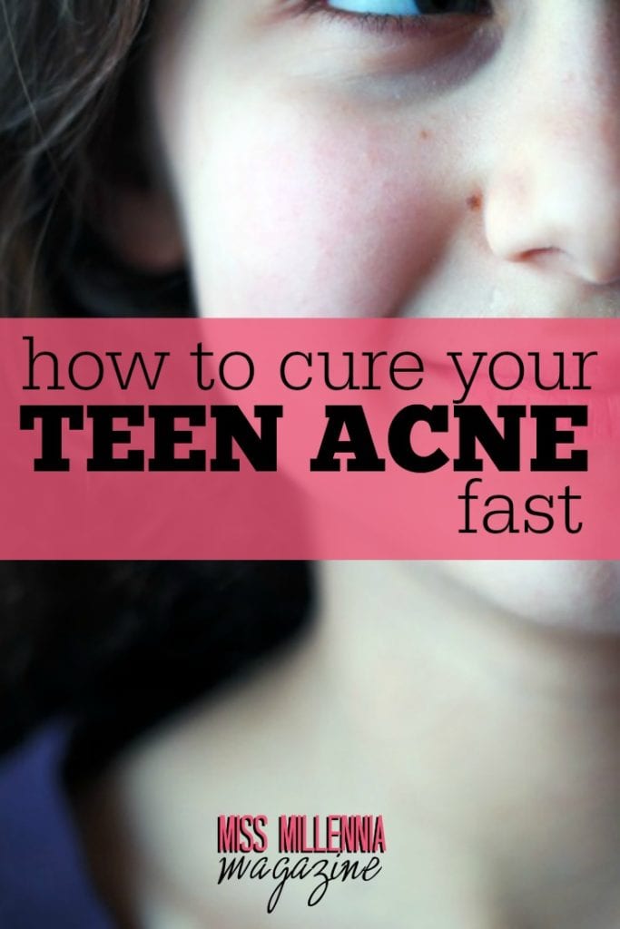 According to studies, as much as 85% of the human race are affected by teen acne. However, this condition can be managed and overtime gotten out of the way.