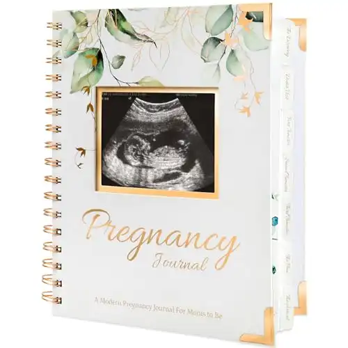 Pregnancy Journal Memory Book – 90 Pages Hardcover Pregnancy Book, Pregnancy Planner, Pregnancy Journals for First Time Moms, Baby Memory Book, Mom Book Diary, Ultrasound Baby Book Memory (Alpin...