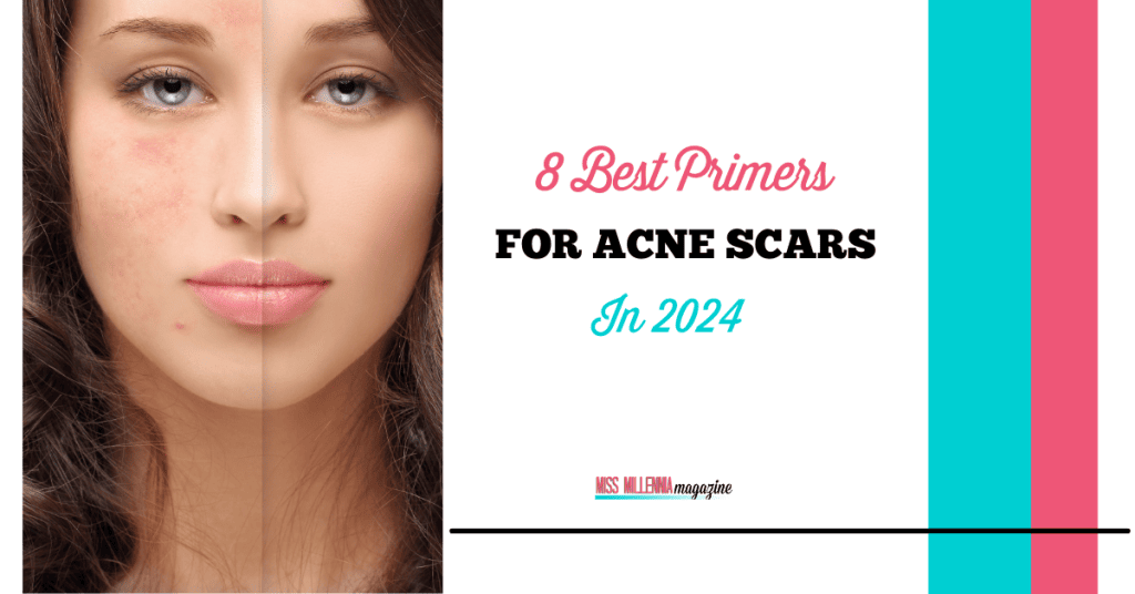 8 Best Primers For Acne Scars In 2024